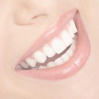 Services Teeth Whitening 200x200 Treatments